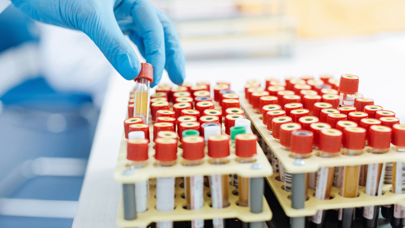 Diploma in Medical Lab Technology (DMLT) 2 years